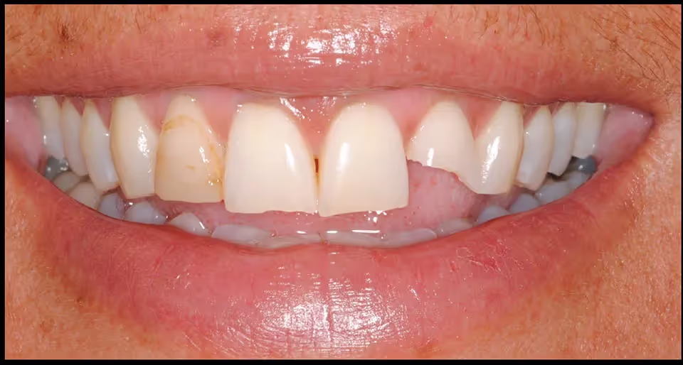 Before Image