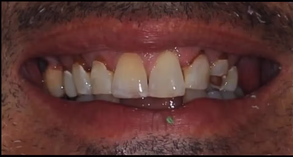 Before Image