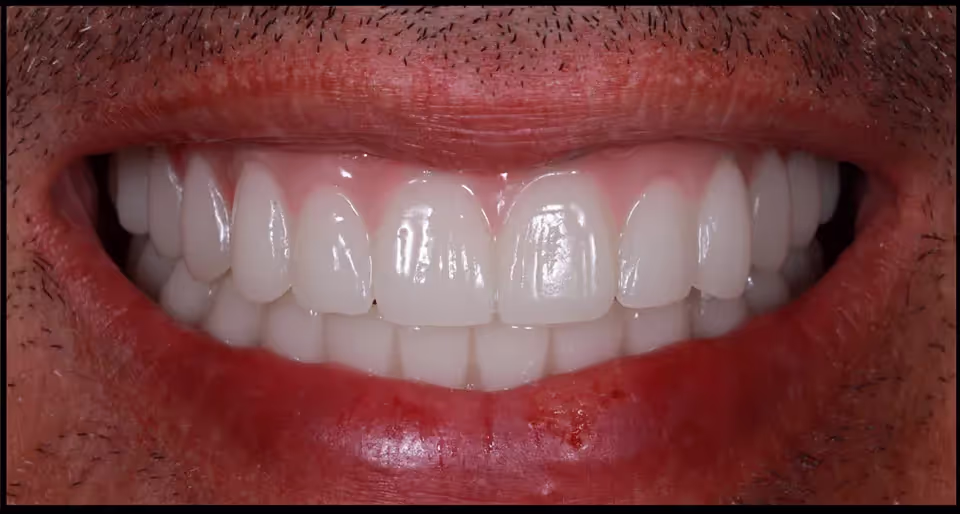 After Image