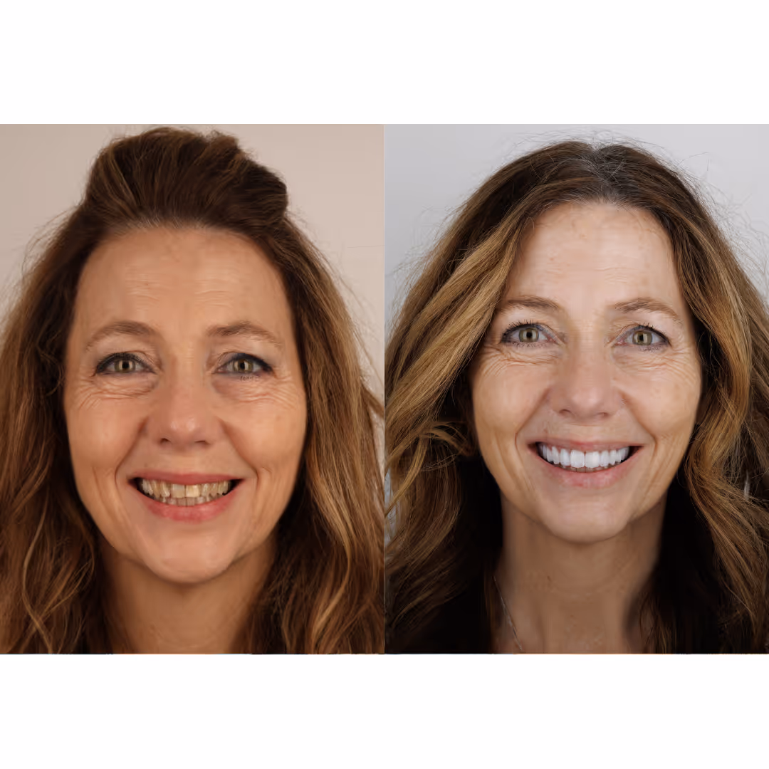 Bee Cave Cosmetic Dentist
