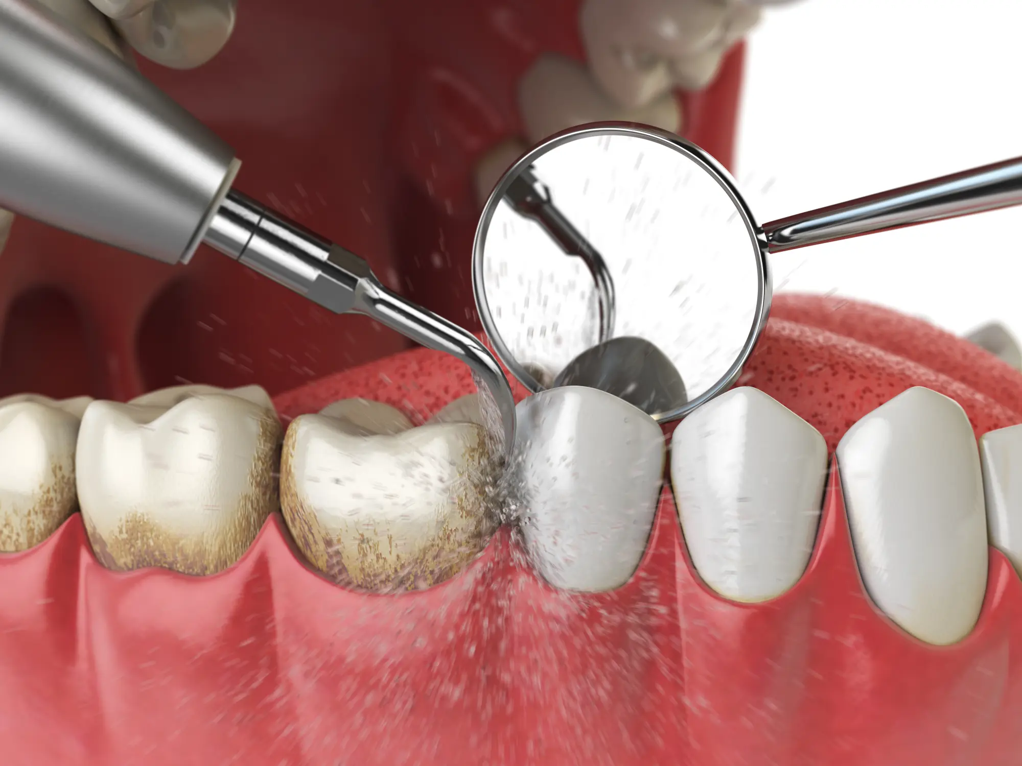 Cleaning & Hygiene in Bee Cave, TX | Tomasik Family Dental